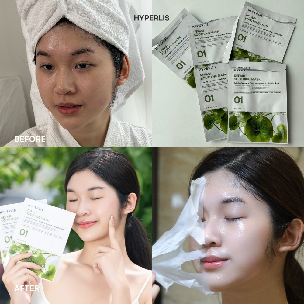 HYPERLIS Before/After 3