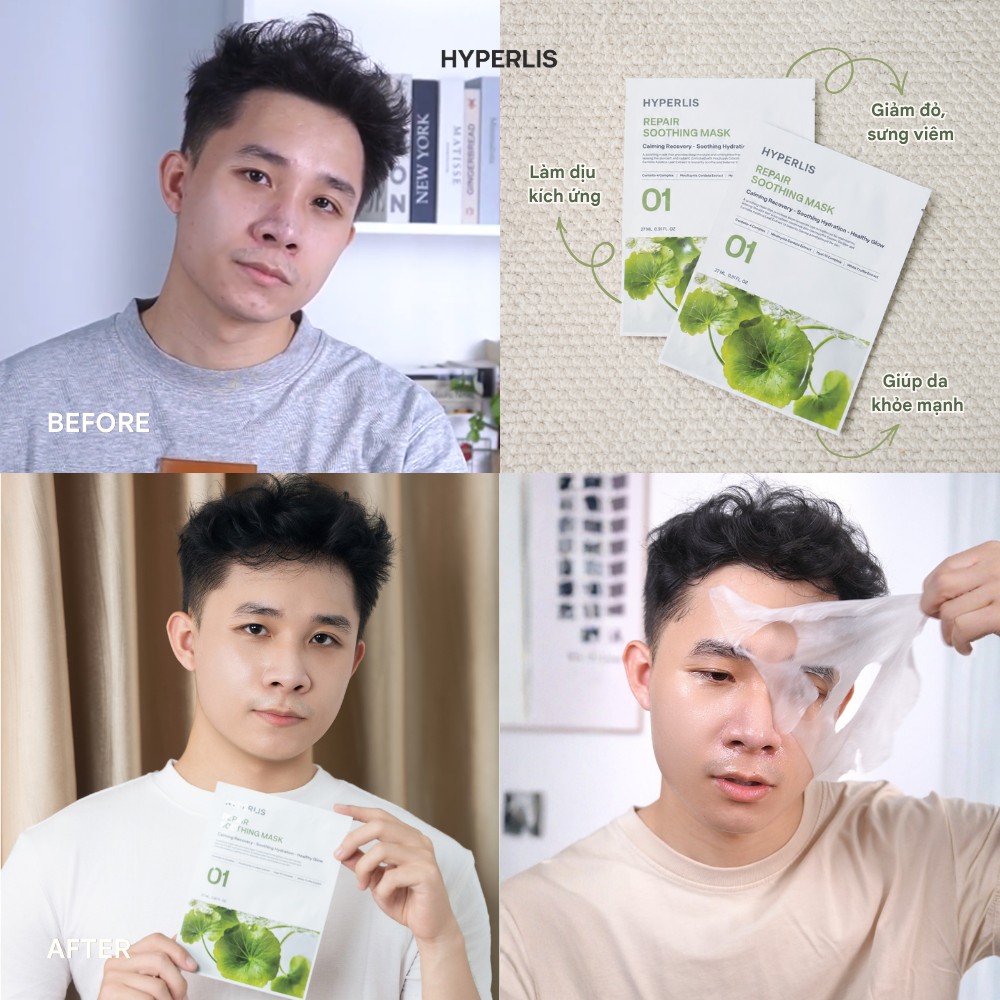 HYPERLIS Before/After 4